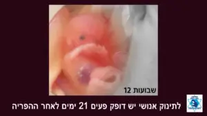 סוכות חיים