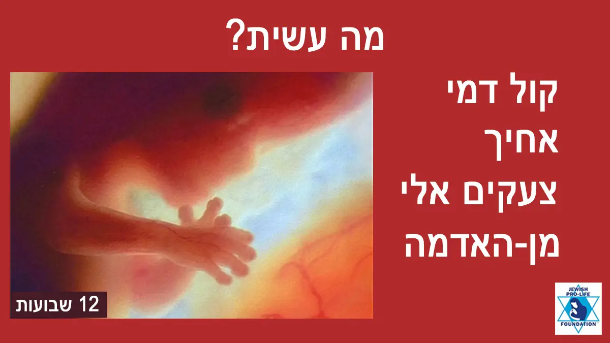 פרשת בראשית כבדו את החיים