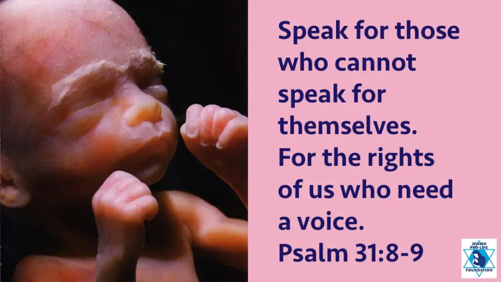 דבר בשם מי שלא יכול לדבר בעד עצמו.