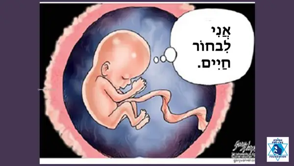בחר בחיים.