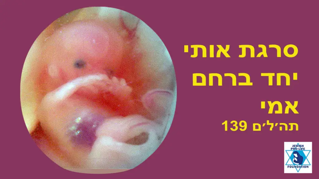 פרשת ויקהל-פקודי