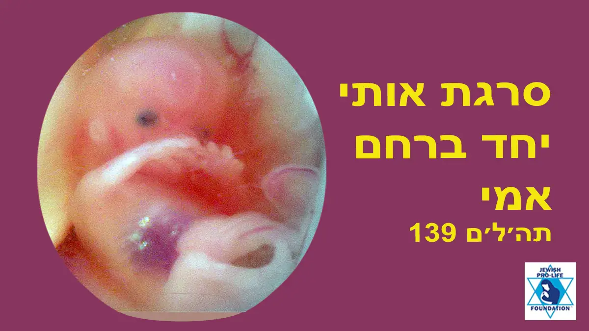 פרשת ויקהל-פקודי